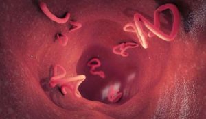 Tapeworm infestation in a dog intestine